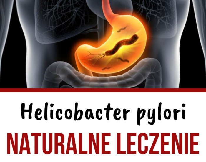 Helicobacter pylori – leczenie naturalne | Dieta, suplementy, zioła