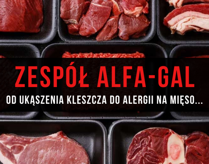 Zespół alfa-gal – od ukąszenia kleszcza do alergii na mięso